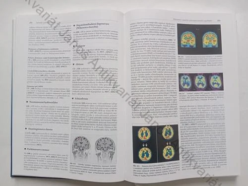 Höschl, Libiger, Švestka - Psychiatrie
