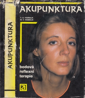 Vogralik - Akupunktura: Bodová reflexní terapie